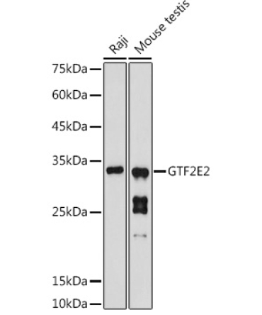 GTF2E2 Rabbit Polyclonal Antibody