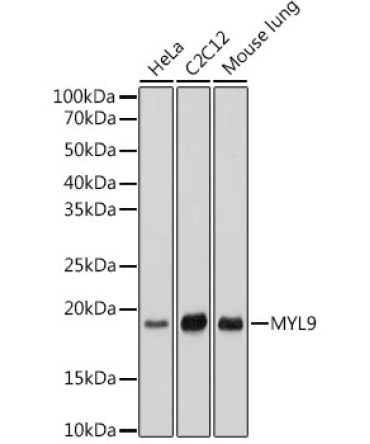 MYL9 Rabbit Monoclonal Antibody