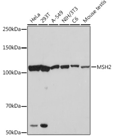 MSH2 Rabbit Monoclonal Antibody