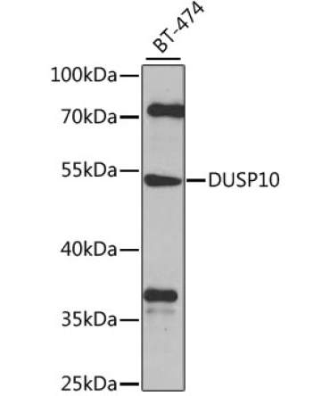 DUSP10 Rabbit Polyclonal Antibody