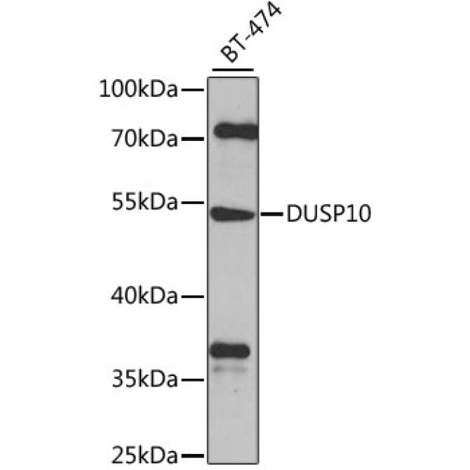 DUSP10 Rabbit Polyclonal Antibody