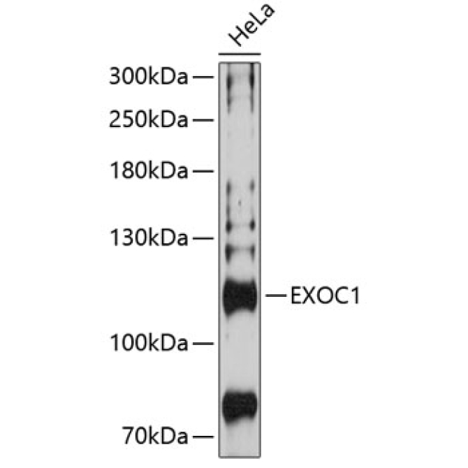 EXOC1 Rabbit Polyclonal Antibody