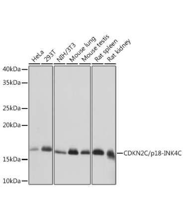 CDKN2C/p18-INK4C Rabbit Monoclonal Antibody [KO Validated]
