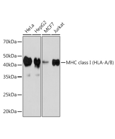 MHC class I (HLA-A/B) Rabbit Monoclonal Antibody