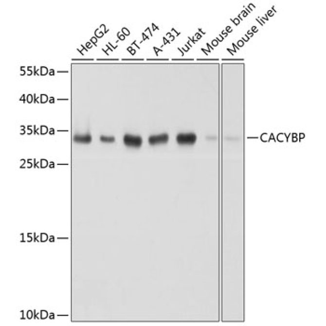 CACYBP Rabbit Polyclonal Antibody [KO Validated]