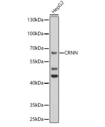 CRNN Rabbit Polyclonal Antibody