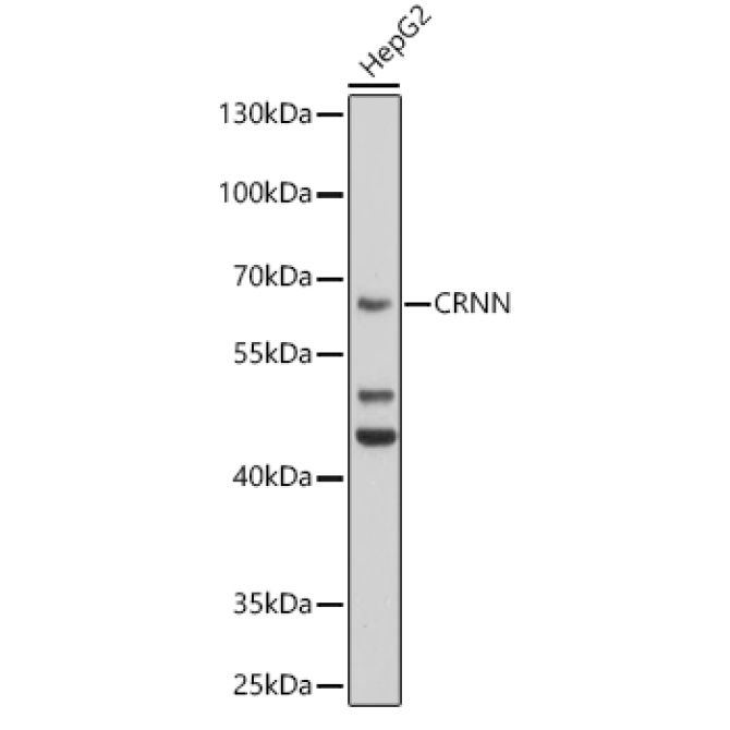 CRNN Rabbit Polyclonal Antibody