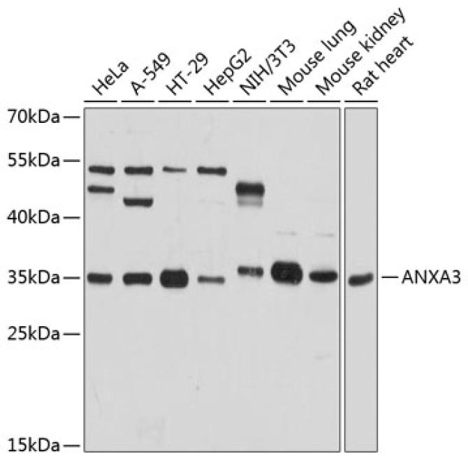ANXA3 Rabbit Polyclonal Antibody
