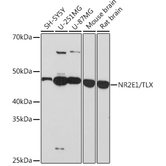 NR2E1/TLX Rabbit Monoclonal Antibody