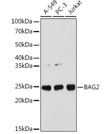 BAG2 Rabbit Monoclonal Antibody