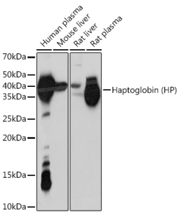 Haptoglobin (HP) Rabbit Monoclonal Antibody