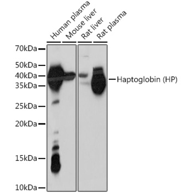 Haptoglobin (HP) Rabbit Monoclonal Antibody