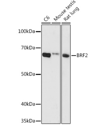 BRF2 Rabbit Polyclonal Antibody