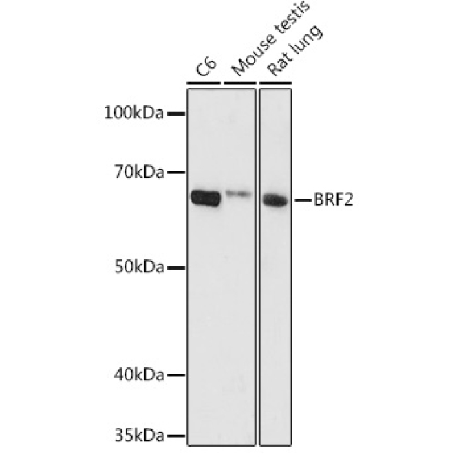 BRF2 Rabbit Polyclonal Antibody