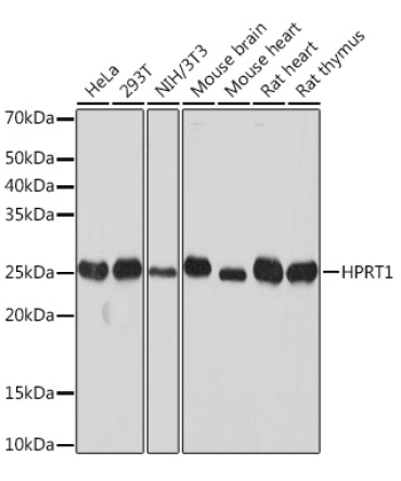 HPRT1 Rabbit Monoclonal Antibody [KO Validated]