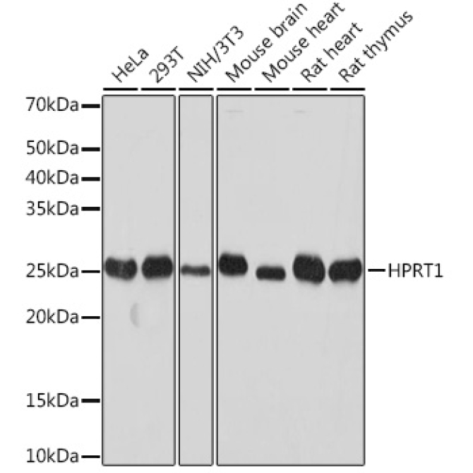 HPRT1 Rabbit Monoclonal Antibody [KO Validated]