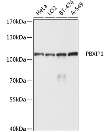 PBXIP1 Rabbit Polyclonal Antibody