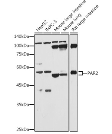 PAR2 Rabbit Polyclonal Antibody
