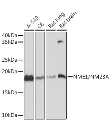 NME1/NM23A Rabbit Monoclonal Antibody
