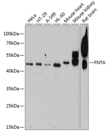 FNTA Rabbit Polyclonal Antibody