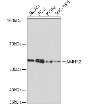 AMHR2 Rabbit Monoclonal Antibody