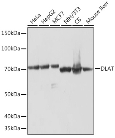 DLAT Rabbit Monoclonal Antibody