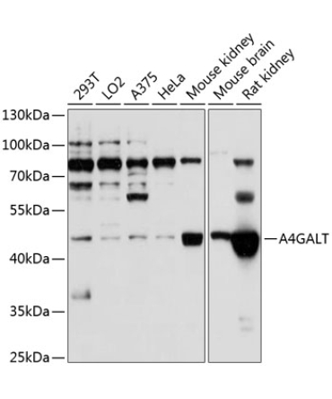 A4GALT Rabbit Polyclonal Antibody