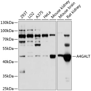 A4GALT Rabbit Polyclonal Antibody