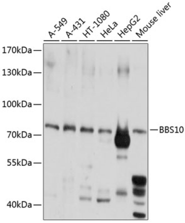 BBS10 Rabbit Polyclonal Antibody