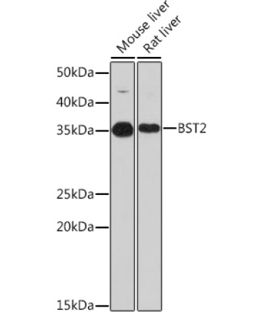 BST2 Rabbit Monoclonal Antibody