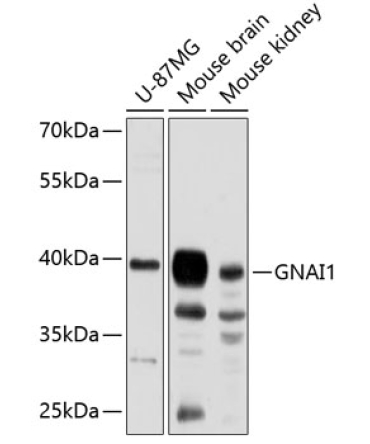 GNAI1 Rabbit Polyclonal Antibody