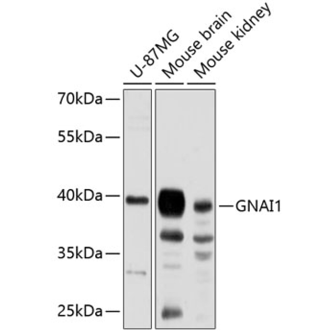 GNAI1 Rabbit Polyclonal Antibody