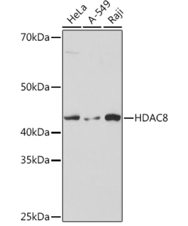HDAC8 Rabbit Monoclonal Antibody [KO Validated]