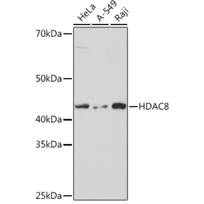 HDAC8 Rabbit Monoclonal Antibody [KO Validated]