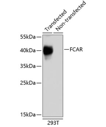 FCAR Rabbit Polyclonal Antibody