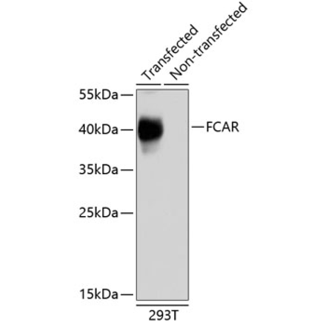 FCAR Rabbit Polyclonal Antibody