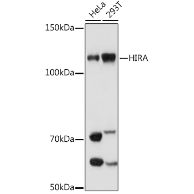 HIRA Rabbit Monoclonal Antibody