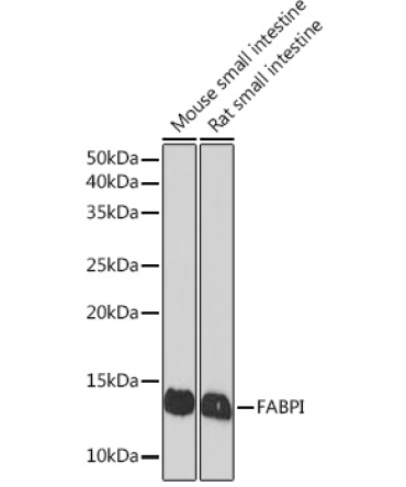 FABPI Rabbit Monoclonal Antibody
