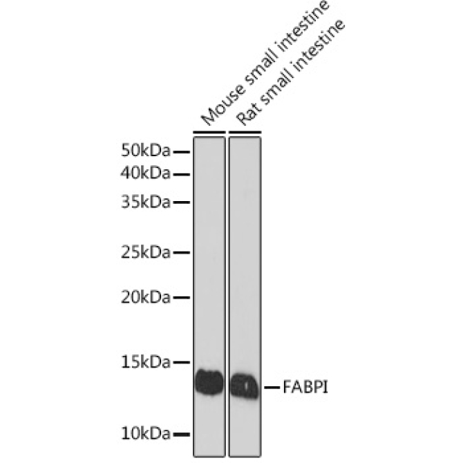 FABPI Rabbit Monoclonal Antibody