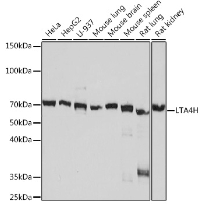 LTA4H Rabbit Monoclonal Antibody