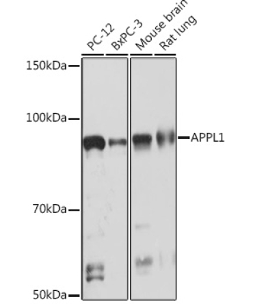 APPL1 Rabbit Monoclonal Antibody