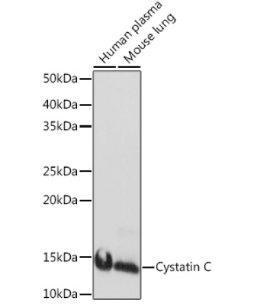 Cystatin C Rabbit Monoclonal Antibody