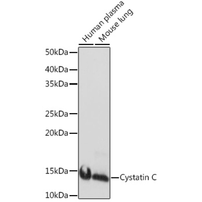 Cystatin C Rabbit Monoclonal Antibody