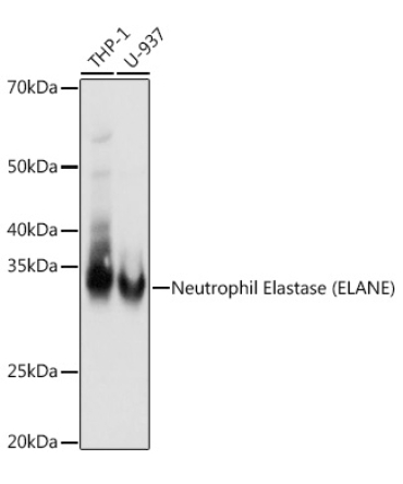 Neutrophil Elastase (ELANE) Rabbit Monoclonal Antibody