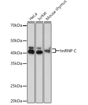 hnRNP C Rabbit Monoclonal Antibody
