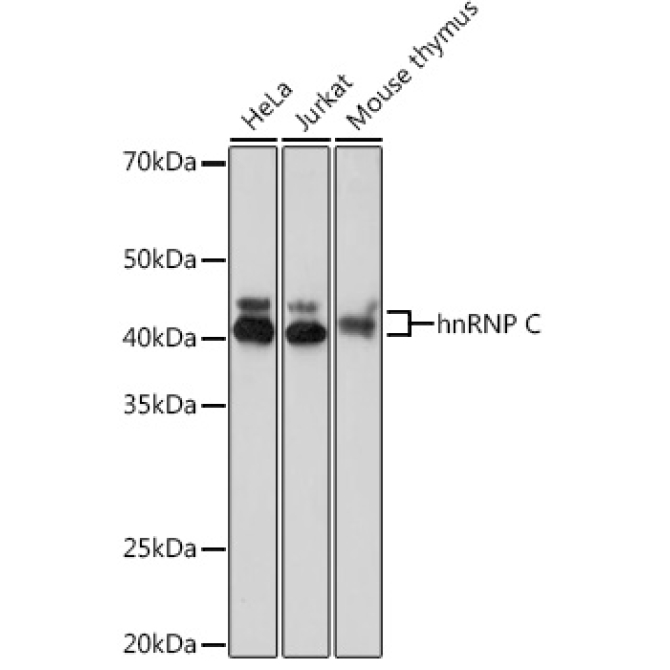 hnRNP C Rabbit Monoclonal Antibody