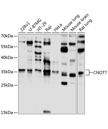 CNOT7 Rabbit Polyclonal Antibody