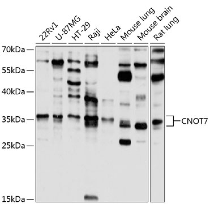 CNOT7 Rabbit Polyclonal Antibody