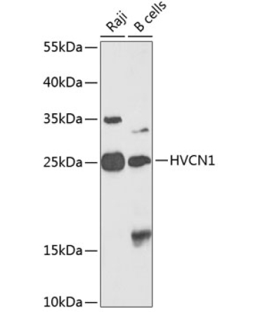 HVCN1 Rabbit Polyclonal Antibody