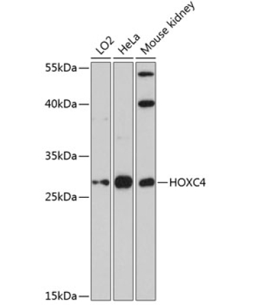 HOXC4 Rabbit Polyclonal Antibody